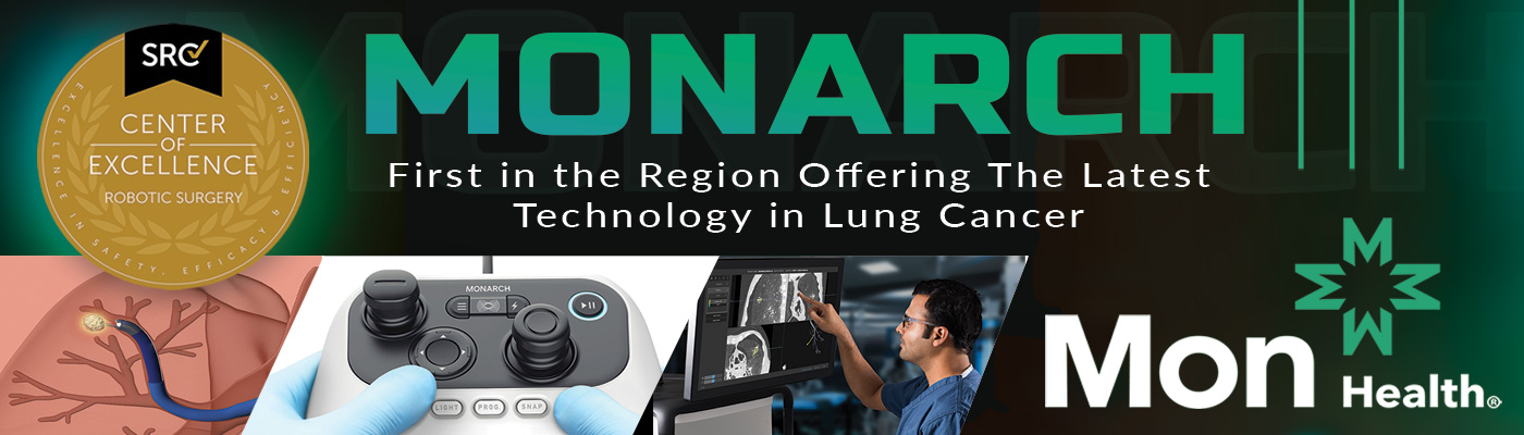 monarch first in the region offering the latest technology in lung cancer
